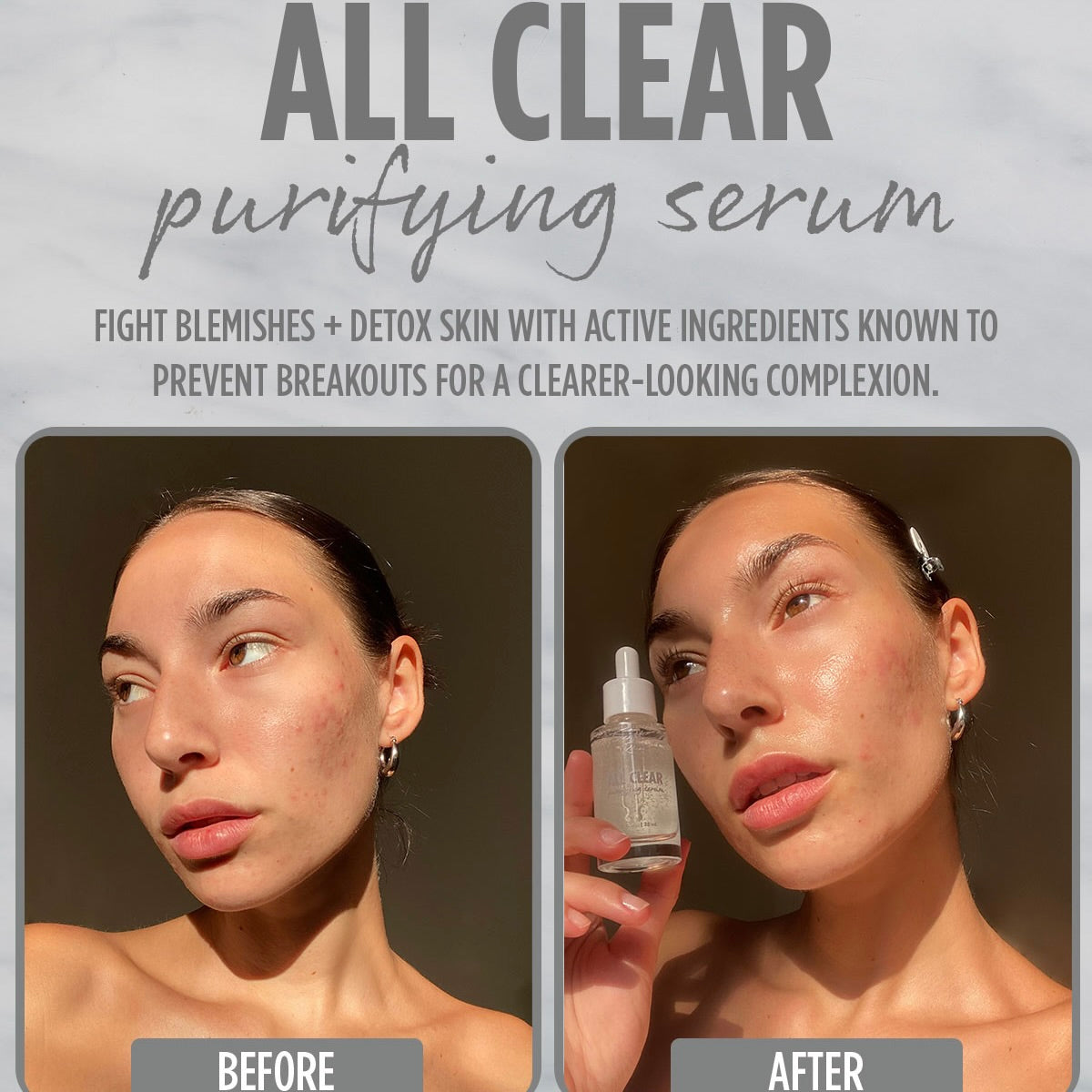 All Clear Purifying Serum - 图片 3